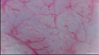 Camera Inside Ass, 9 Throbbing Pulsing Anal Orgasms, Live Stethoscope Heartbeat - Full Clip