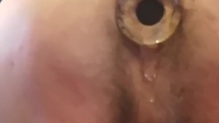 Glass plug insertion - Look through the porthole :)