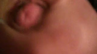 Masturbe (46) with one testicle