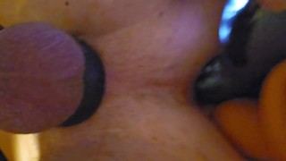 Asshole training and Open
