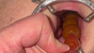 Gay ass dilator