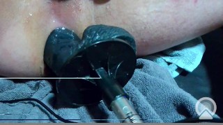 anal fuckingmachine anal orgasem