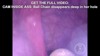 BEST Minicam Compilation in my Ass and Bladder - Get all Videos on Manyvids and Fansly!
