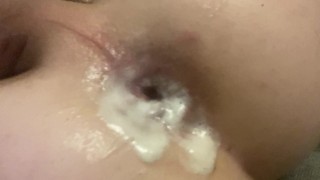 MY ASS IS CUMMING!! Close up prostate milking and ASMR anal sounds