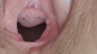 Destroyed & Gaping - Asshole & Pussy Fisting