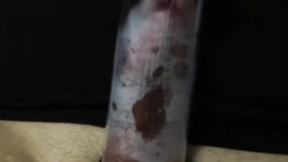 Asian Guy with Penis Pump Until He Cums