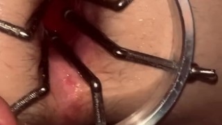 Ass stretching with dilator